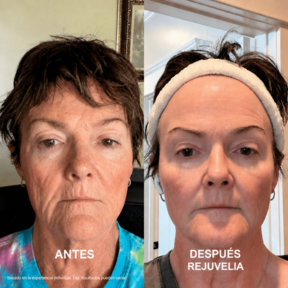 Piel Más Firme, Lisa y Luminosa sin Bótox ni Tratamientos Caros