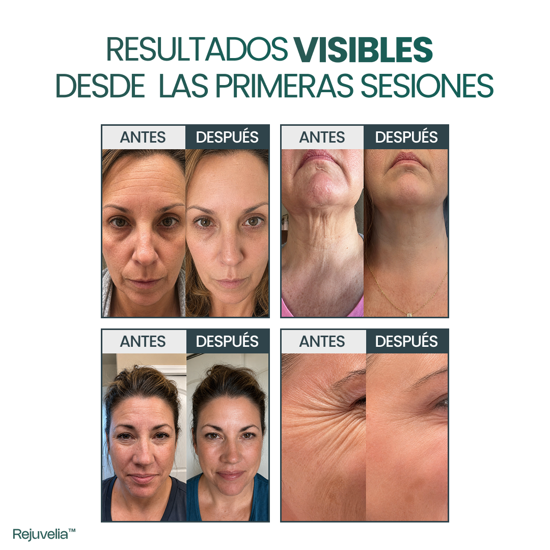 Piel Más Firme, Lisa y Luminosa sin Bótox ni Tratamientos Caros