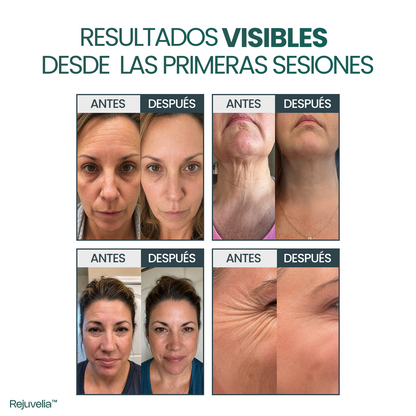 Piel Más Firme, Lisa y Luminosa sin Bótox ni Tratamientos Caros